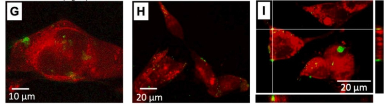 Исследование токсичности наночастиц MOFs, конъюгированных с флуоресцентным красителем (помечены зеленым цветом), на клетках мышиной меланомы (помечены красным цветом). Изображения были получены с помощью конфокальной лазерной сканирующей микроскопии.Изображение предоставлено Ириной Корякиной.
