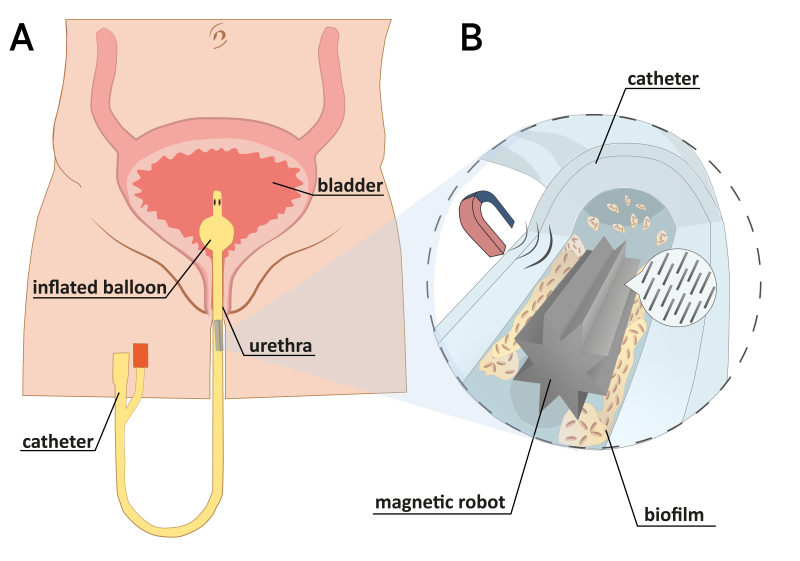 Schematic illustration of magnetic soft robot for biofilm removal. Illustration of the proposed concept of cleaning biofilm from a urethral catheter with a soft robot, actuated by a magnetic field. (A) Urethral catheter wearing; (B) proposed magnetic soft robot for biofilm removal. Illustration from the article. Credit: ACS Nano
