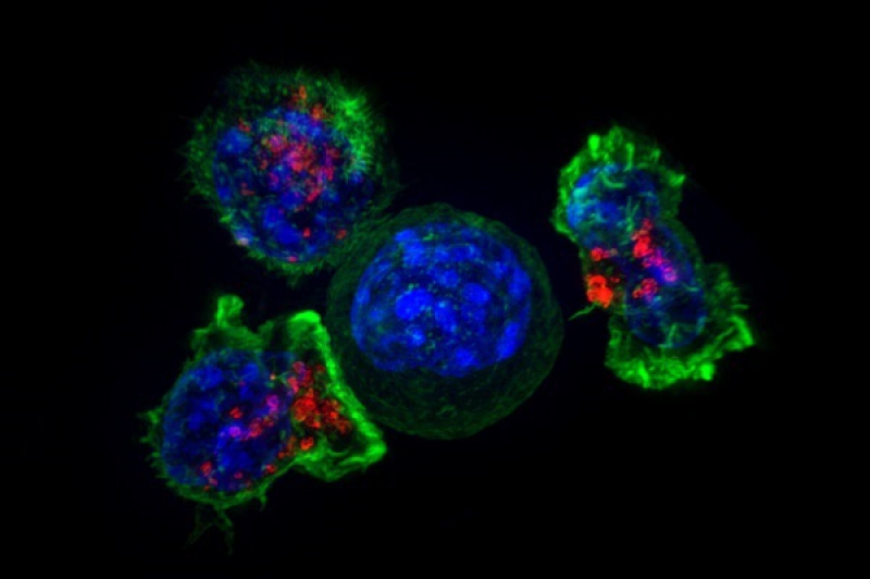 Т-лимфоциты вокруг раковой клетки. Источник: en.wikipedia.org