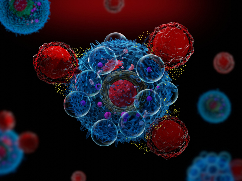 Cancer cells. Credit: shutterstock.com