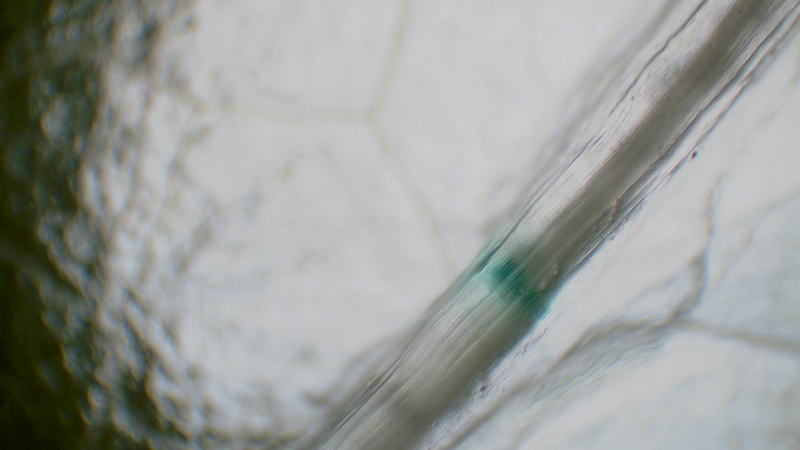 A model thrombus dyed in blue inside the decellularized leaf vasculature, light microscopy. Image courtesy of Aleksandra Predeina
