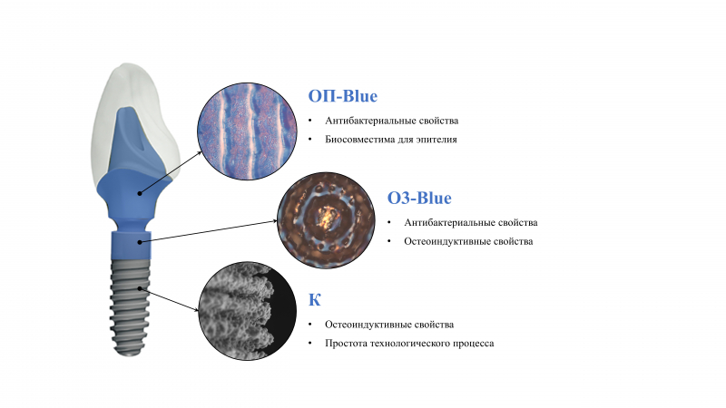 Концепция имплантата. Изображение предоставлено сотрудниками лаборатории лазерных микро- и нанотехнологий ИТМО
