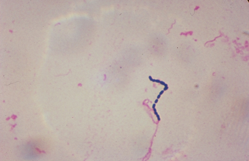 Streptococcaceae bacteria. Credit: USDA // Wikimedia Commons 
