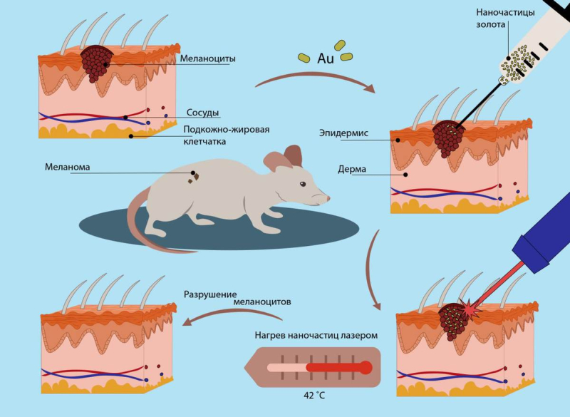 Схема работы фототермической терапии на примере лабораторной мыши с меланомой. Инфографика: Дарья Боголюбова / ITMO.NEWS
