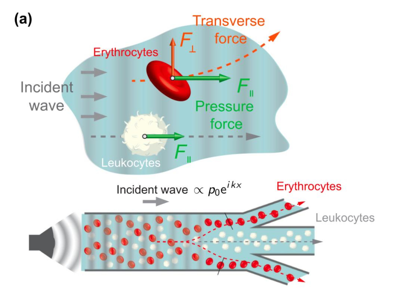 Schematics of the possible application of acoustic lift for acoustofluidic separation of the white and red blood cells using their shape anisotropy. Illustration by the researchers
