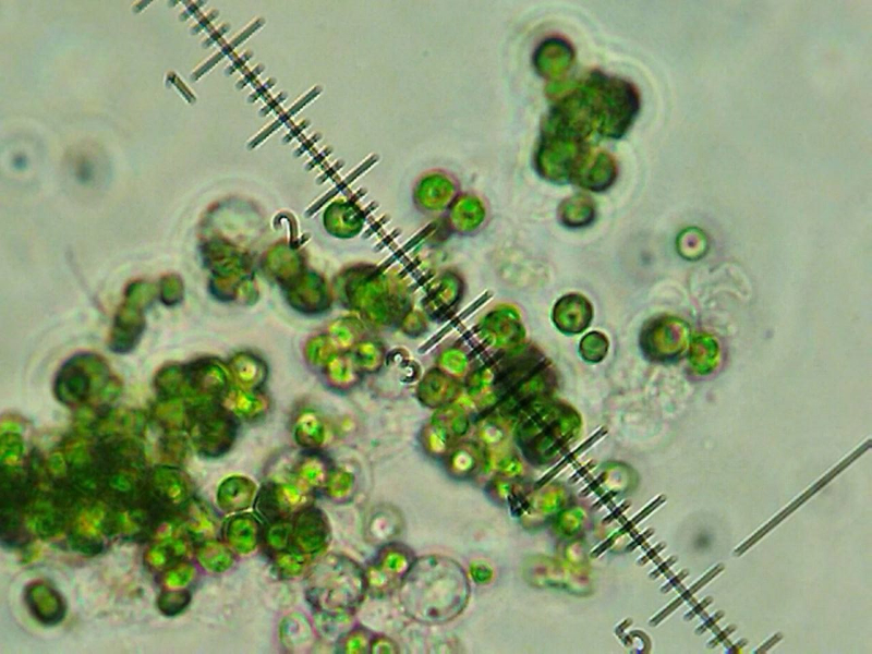 Снимки клеток с микроскопа. Фото предоставлено учеными
