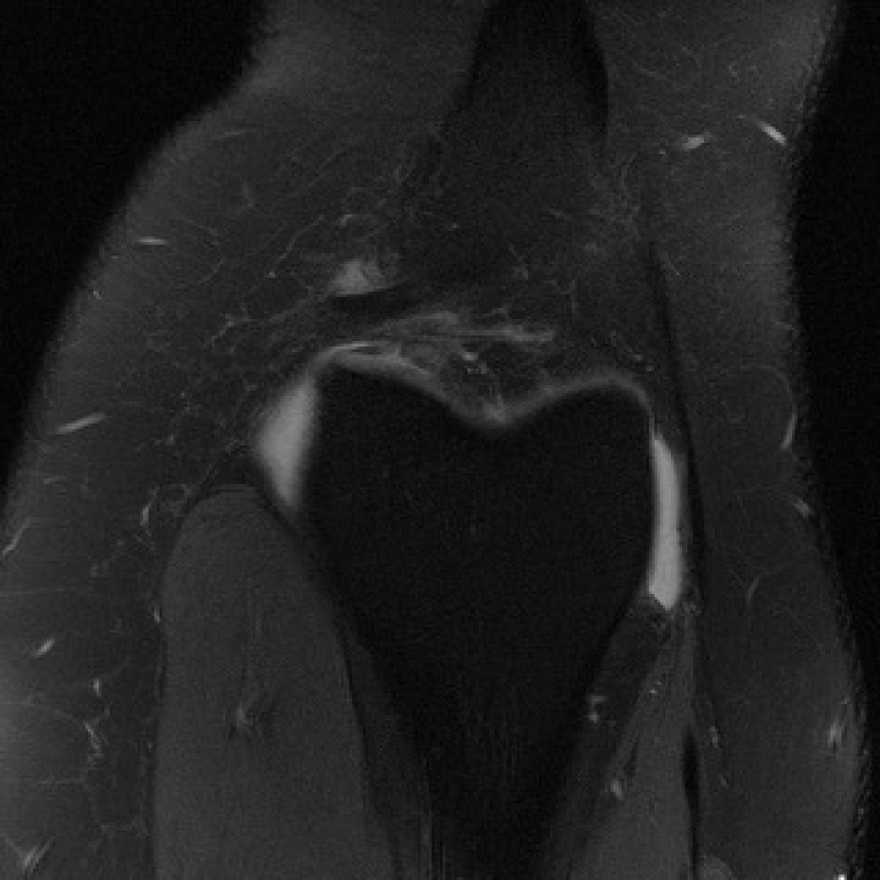 Реальный МРТ снимок. Изображение предоставлено учеными
