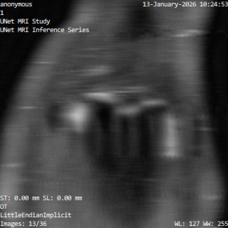 Неполные данные, по которым восстанавливался снимок.&nbsp;Изображение предоставлено учеными
