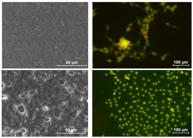 Images of films made of PHAs (left) and myoblast cells that grow on the obtained films (right). Credit: Federal Research Center "Krasnoyarsk Science Center of the Siberian Branch of the Russian Academy of Sciences"
