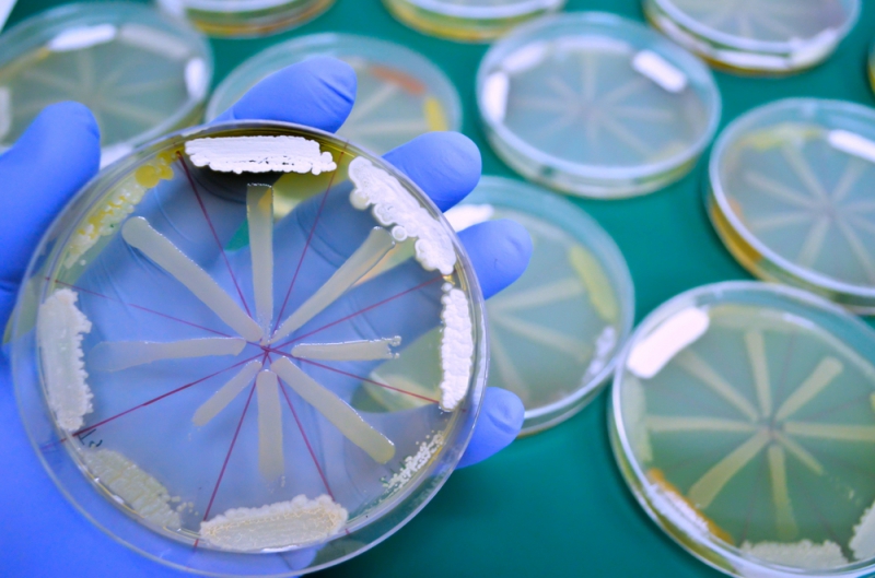 Antibiotic response testing.