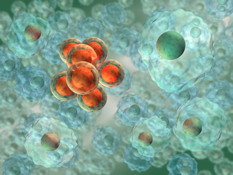 Cell differentiation: normal cells turning into cancer cells. Credit: shutterstock.com