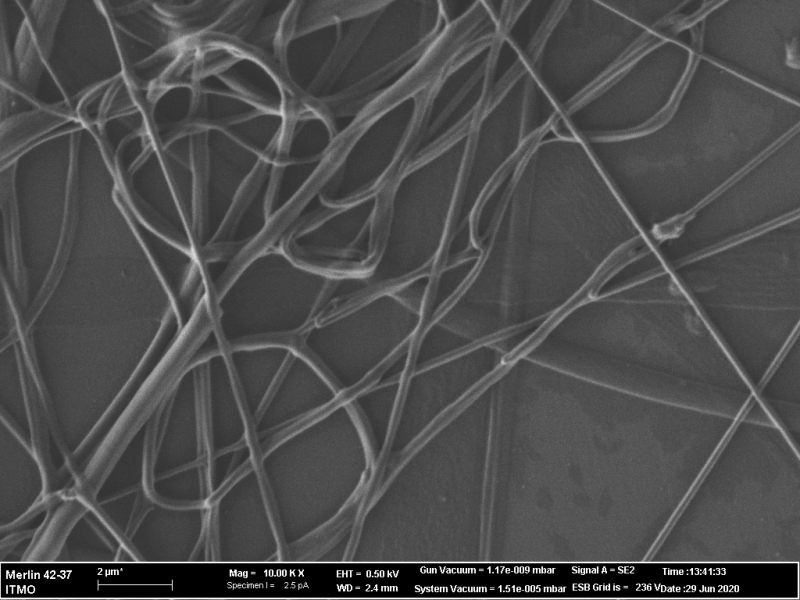 Photomicrograph obtained with a scanning electron microscope. Image courtesy of the researchers